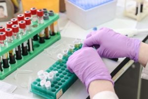laboratorium w prywatnym ubezpieczeniu zdrowotnym